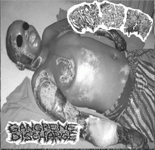 Gangrene Discharge : Gangrene Discharge - Grotesque Bowel Eruption